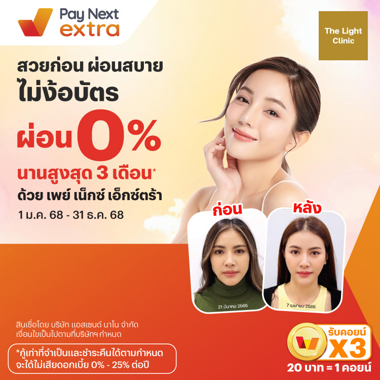 โปรโมชันทรูมันนี่